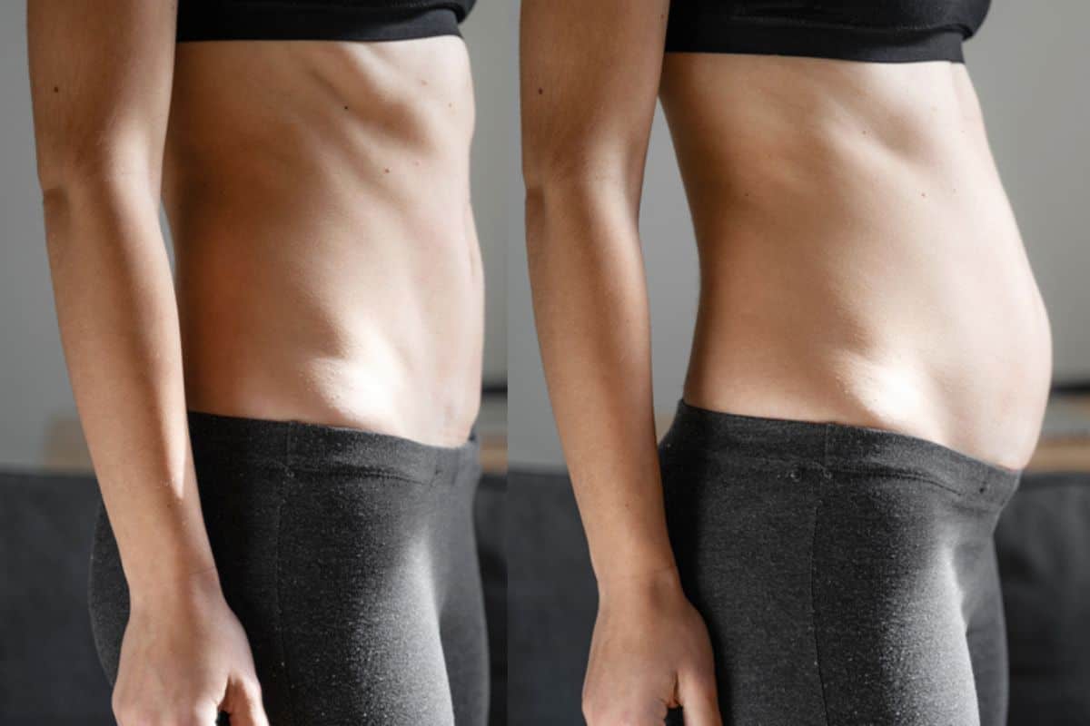 How long does diastasis recti take to improve Bracknell?
