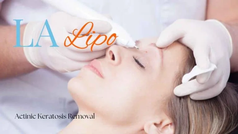 Woman receiving Actinic Keratosis Removal Treatment Bracknell