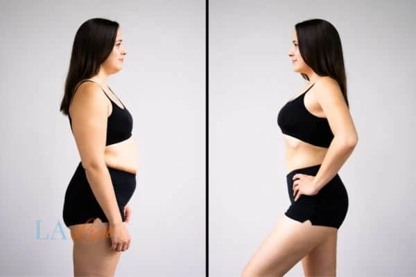 LA-EMS Body Sculpting Bracknell results before and after of womans results on body toning.