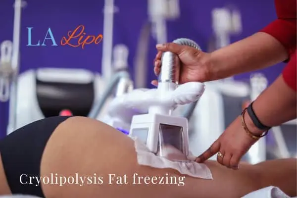 women getting fat freezing Bracknell