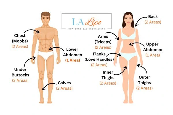 LA LIPO Cryolipolysis Areas Bracknell