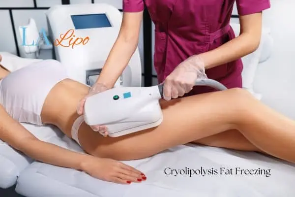 Woman receiving coolsculpting Bracknell treatment on her thighs