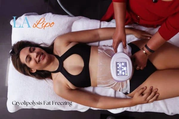 woman getting cryolipolysis Bracknell