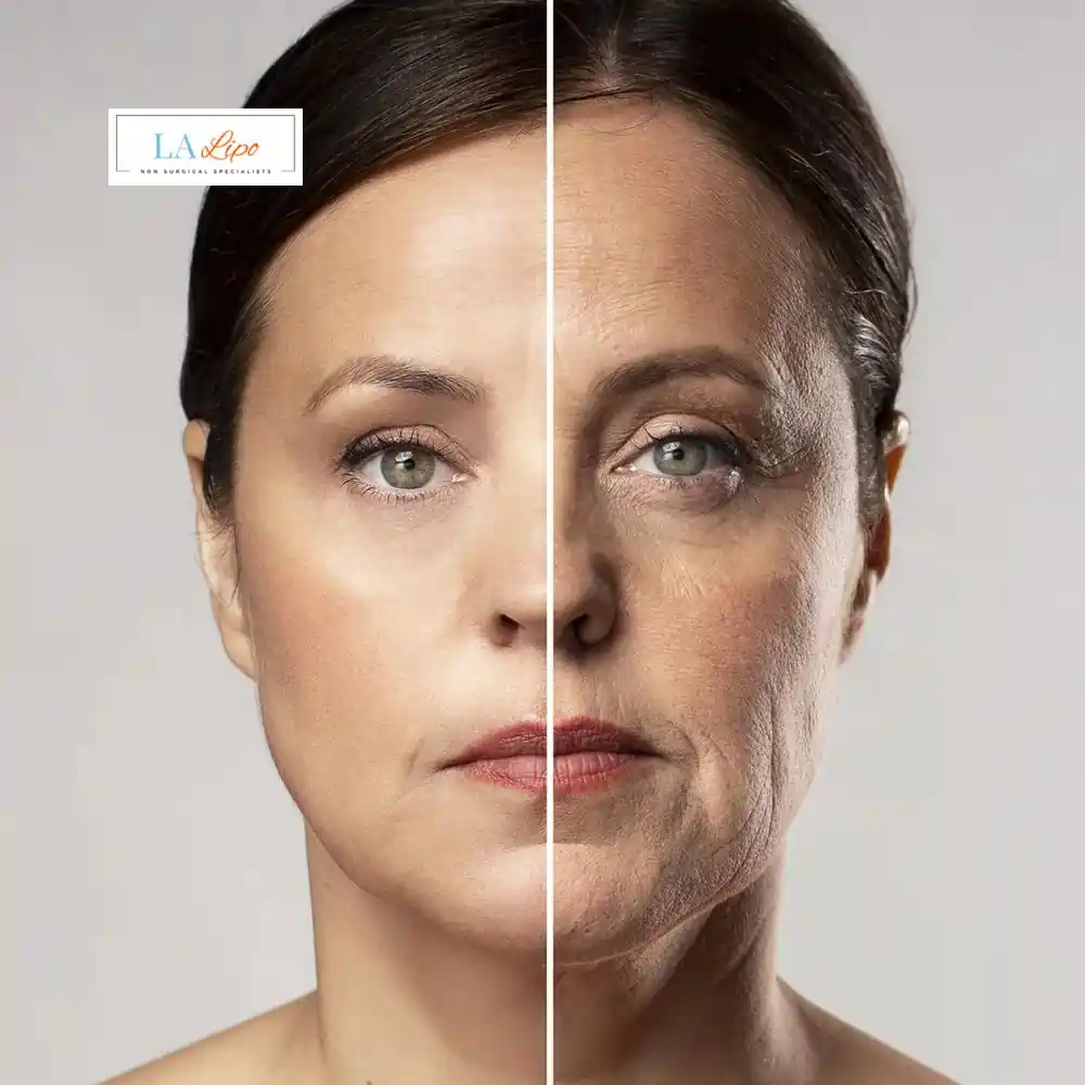 How Can You Tell If Non-Surgical Skin Tightening Is Right for You Bracknell?