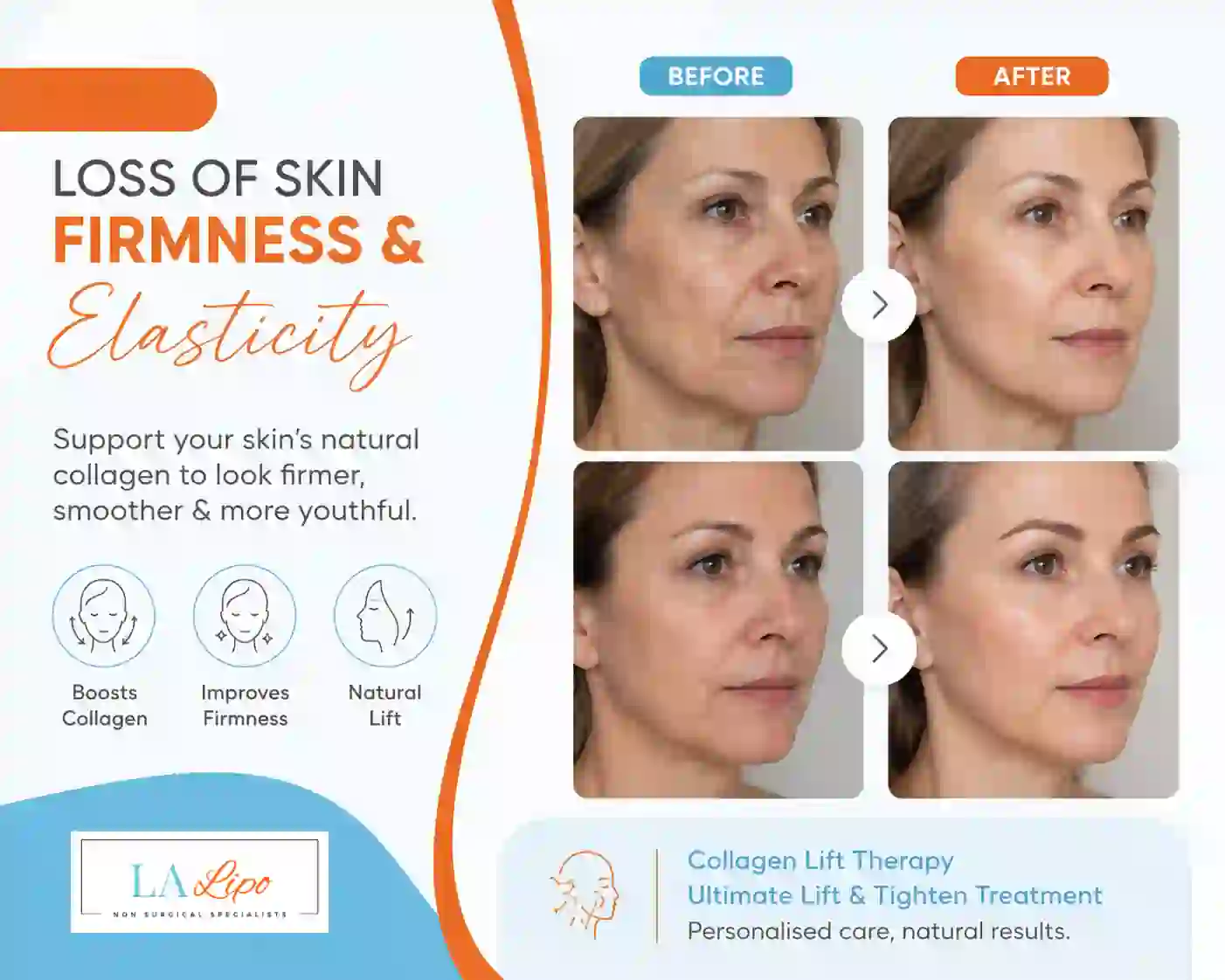 Sign #7: Loss of Skin Firmness and Elasticity Bracknell