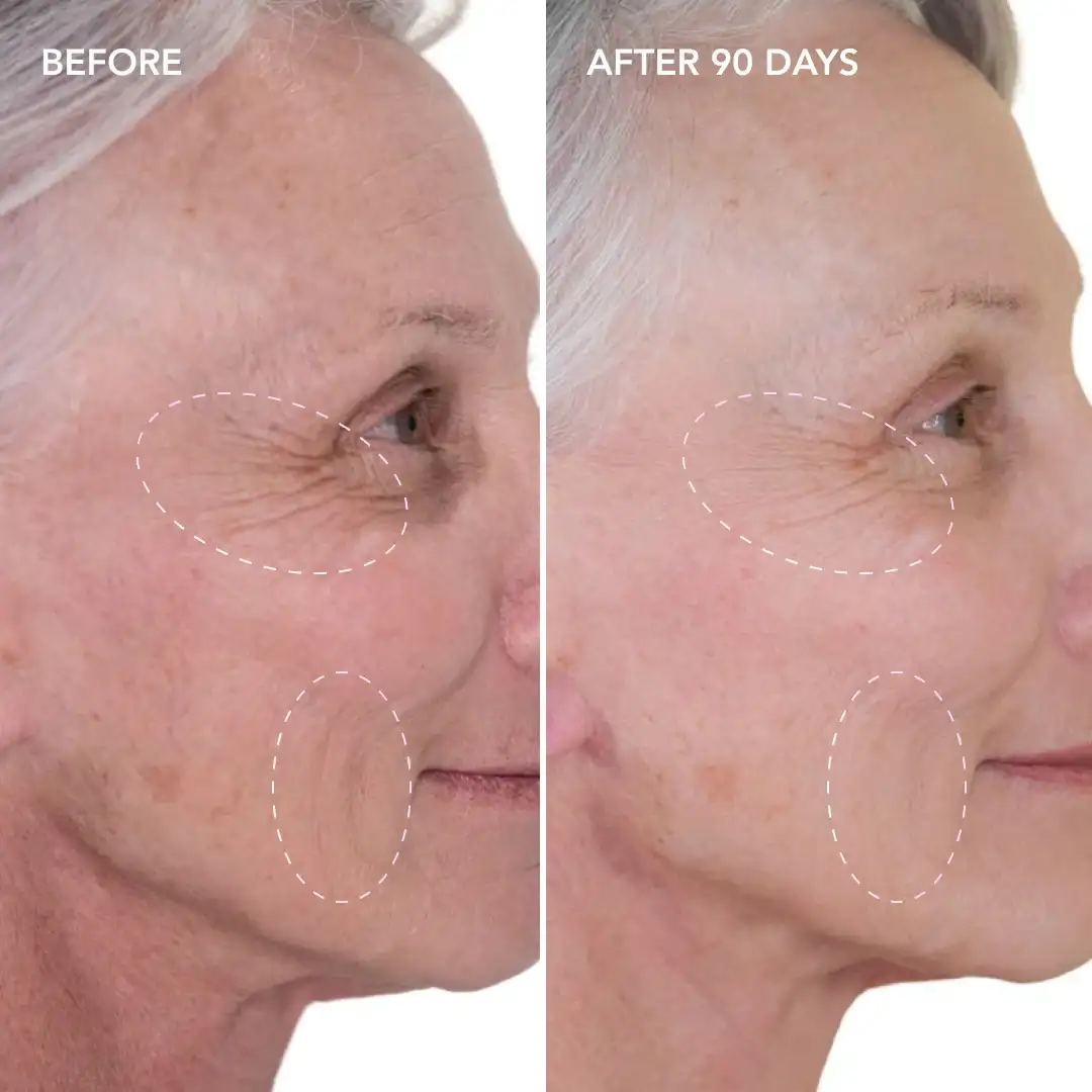 When will you see results Bracknell